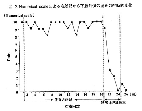 椎間板ヘルニアの鍼灸に関する参考図1