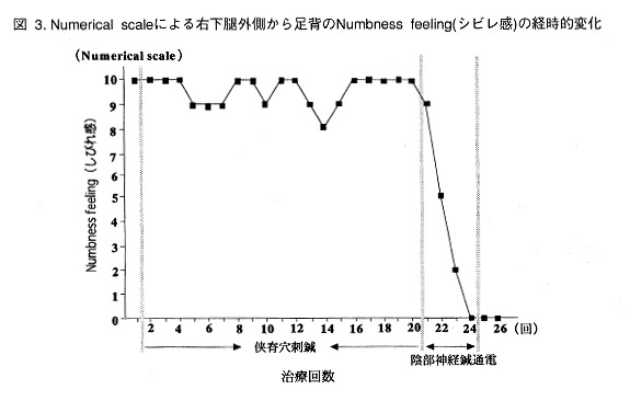椎間板ヘルニアの鍼灸に関する参考図2