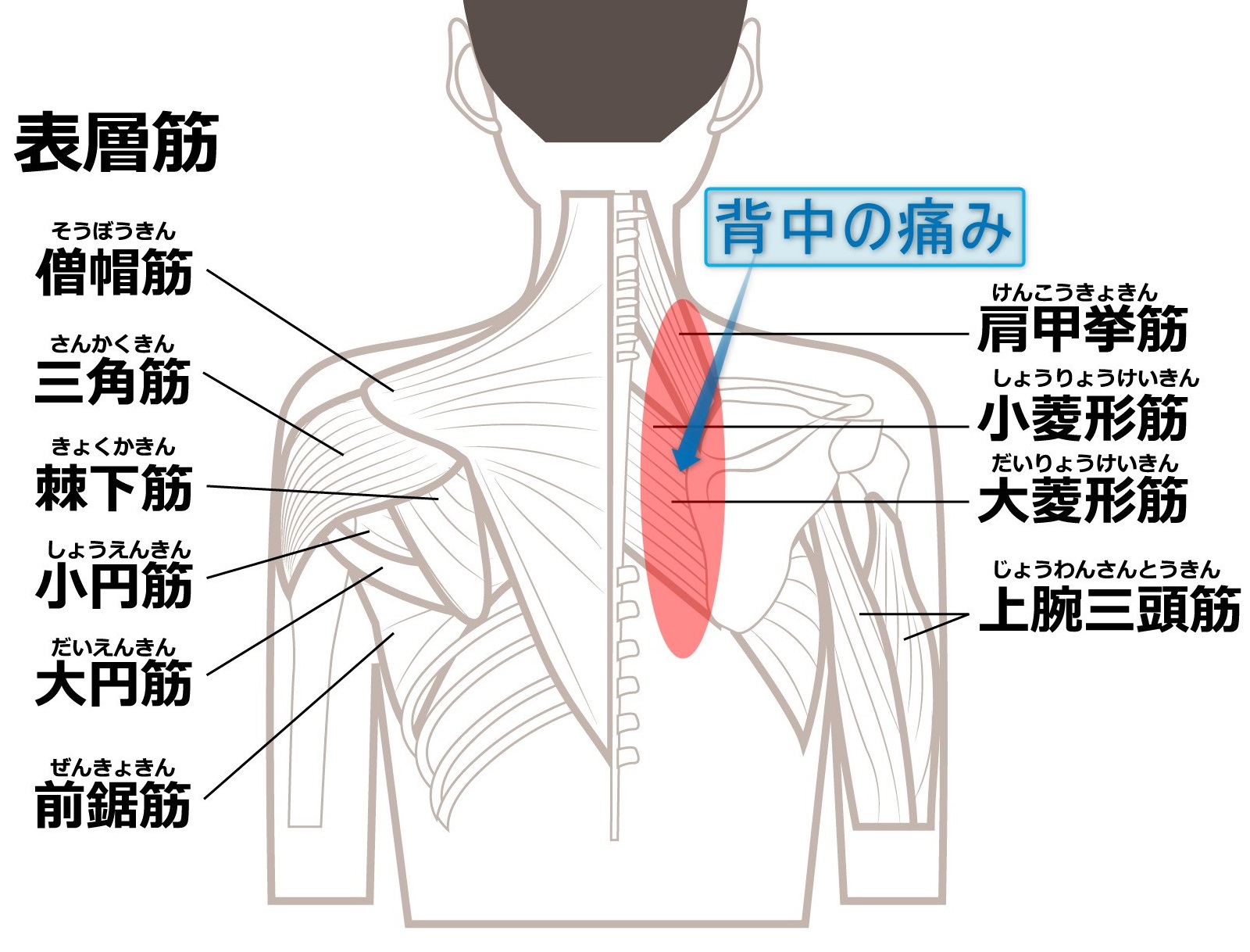 肩甲骨の内側の痛み — 深部の筋肉の位置の参考図
