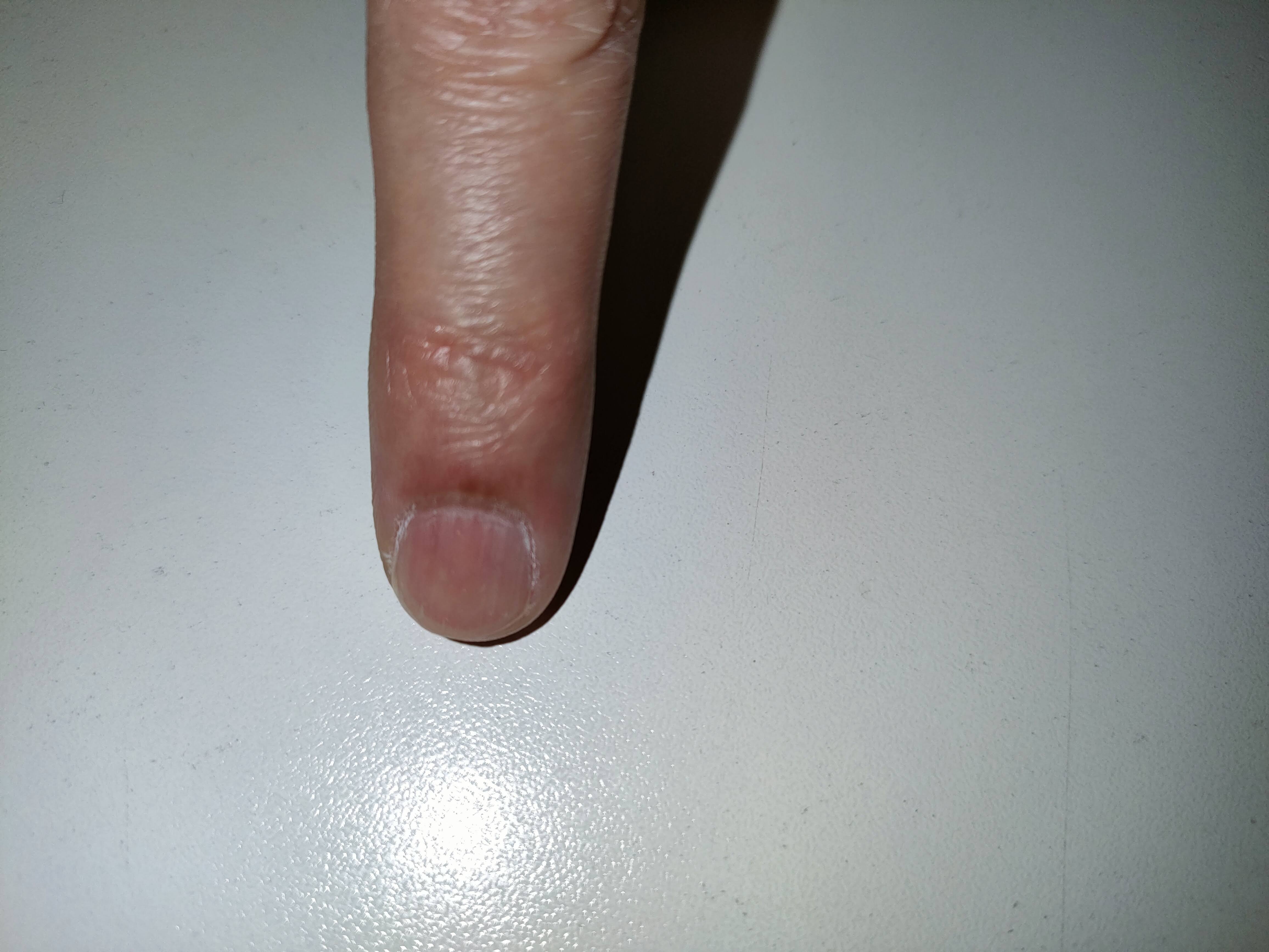 指先で押さえる前の爪の状態