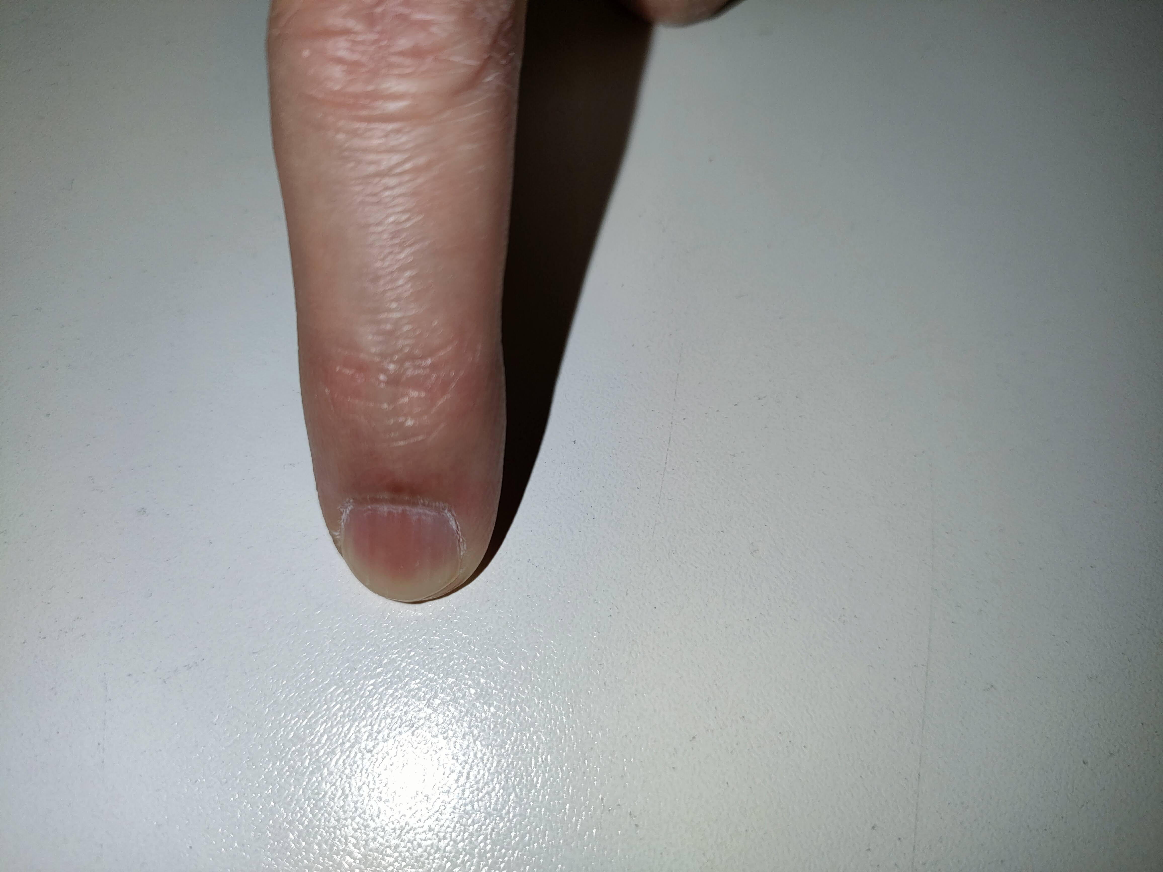 軽く押さえたとき、爪の先端がほんの少し白くなる程度の目安